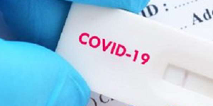 西甲收到第二批病毒试剂 要求低调检测