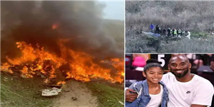 科比被烧成啥样了