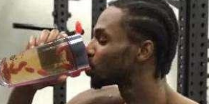 维金斯烫伤是怎么回事